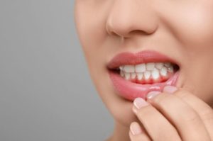 Gum Disease Symptoms: Swelling of Gums